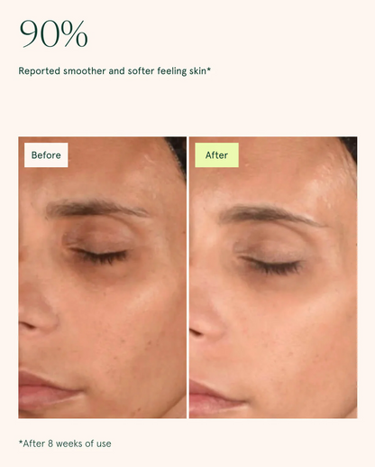 Toning Pads